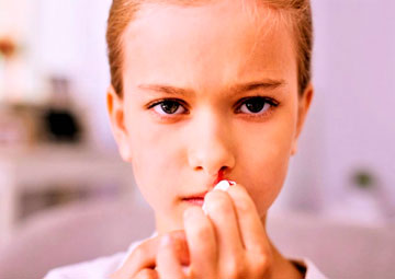 Кровотечение из носа у ребенка